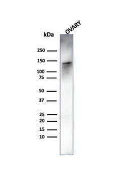 Caldesmon/CALD1 Antibody (rCALD1/820) - Azide and BSA Free, Novus Biologicals 100 &mu;g | Buy Online | Novus Biologicals | Fisher Scientific